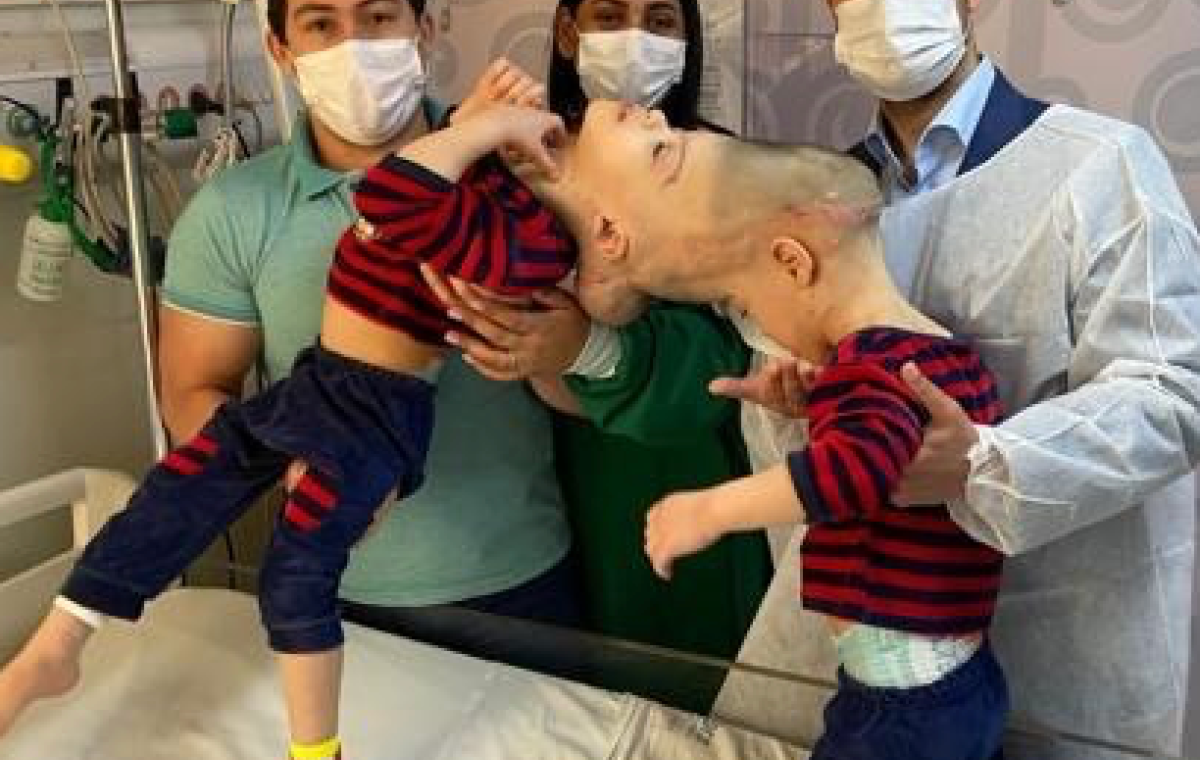 An image of Arthur and Bernardo, craniopagus twins, before their separation surgery. They are being held up by their parents and a doctor, and are on a hospital bed.