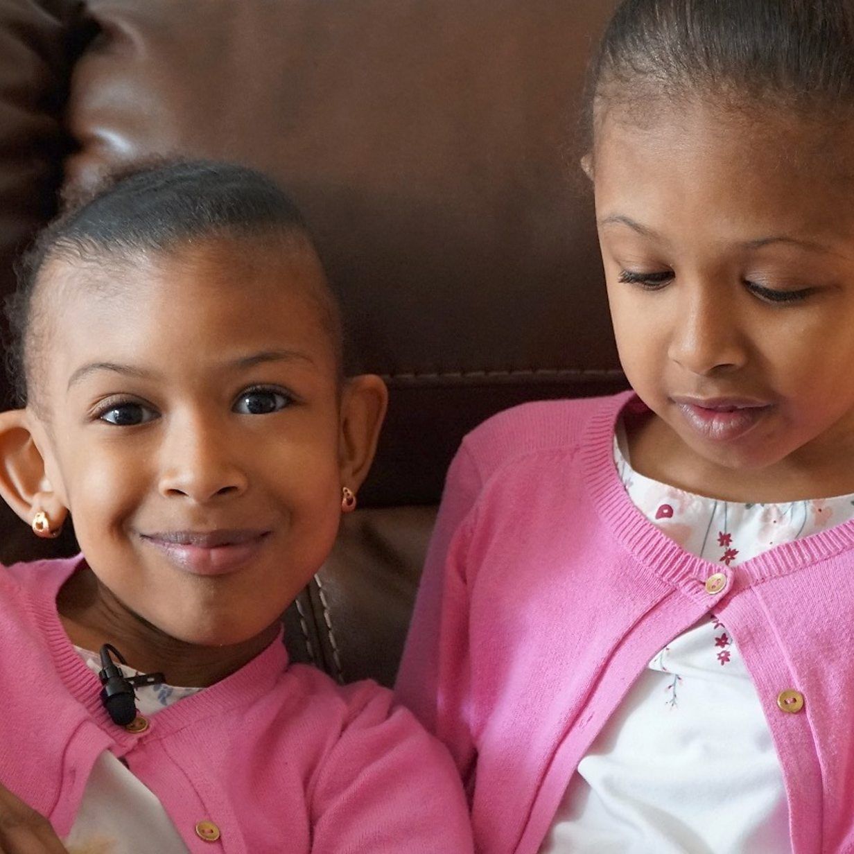 Rital and Ritag, two craniopagus twins separated by surgery at birth. It is a close-up portrait. One of them looks at the camera, the other is looking away.