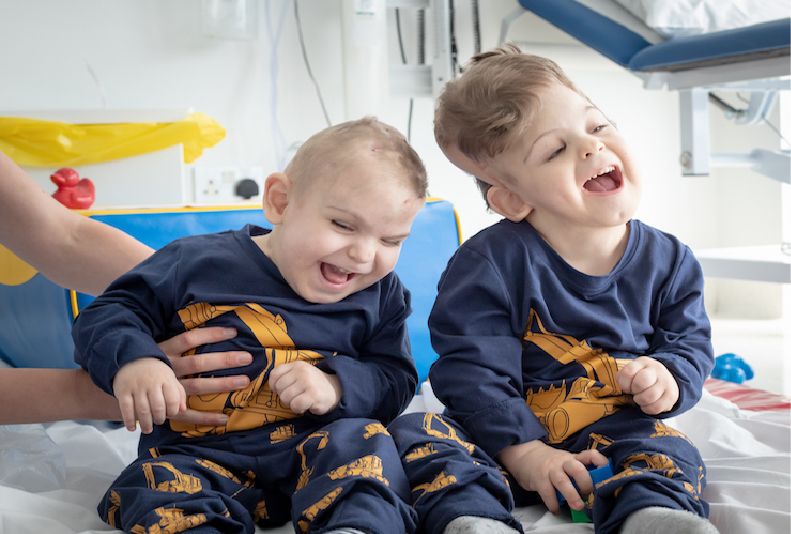 Yigit and Derman, two craniopagus twins, smile happily post-operation, they are in a hospital.