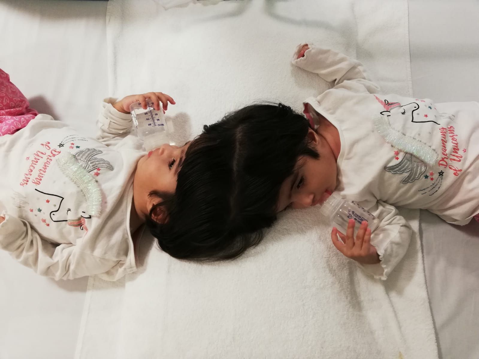Safa and Marwa, craniopagus twins, lie on a bed pre-surgery. They are drinking water.