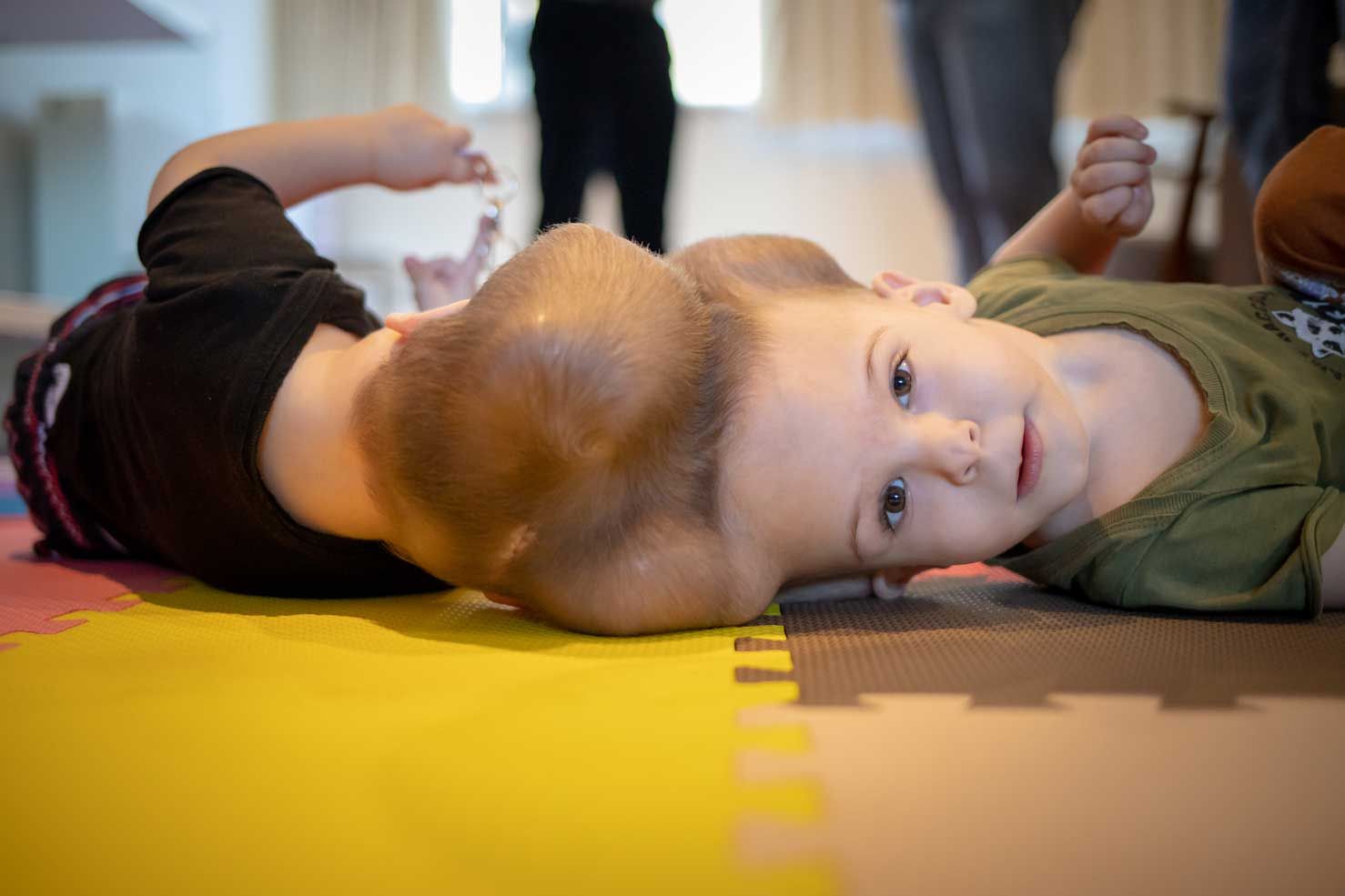 Yigit and Derman pre-operation, lying on a padded floor.