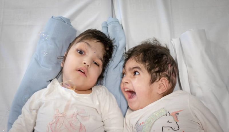 Safa & Marwa lie on a bed post-operation. One of them smiles happily at the other.