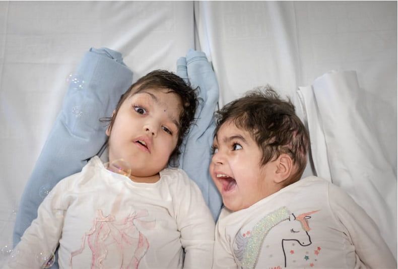Safa & Marwa lie on a bed post-operation. One of them smiles happily at the other.