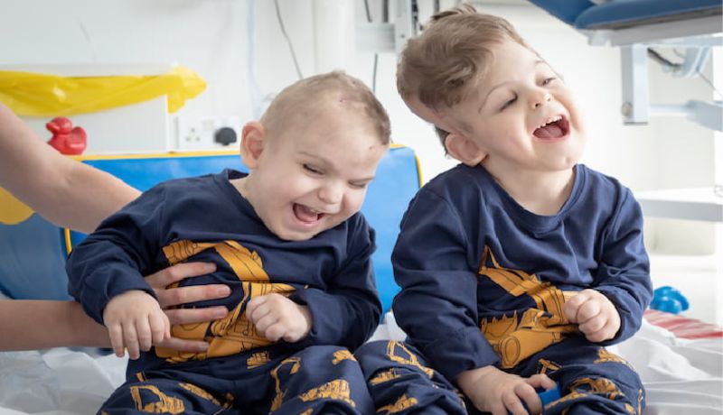 Yigit and Derman, two craniopagus twins, smile happily post-operation, they are in a hospital.